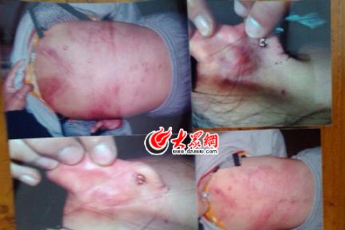 　山東藝術(shù)設(shè)計(jì)學(xué)院16歲女生宿舍內(nèi)被女同學(xué)暴打4小時(shí)。