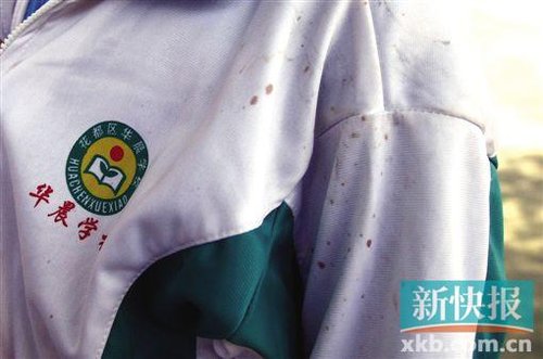 小吳的校服上留有血跡 小吳的校服上留有血跡