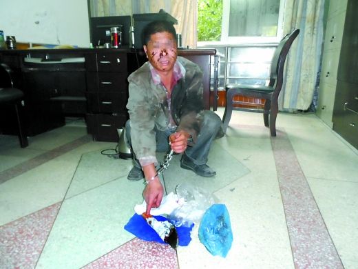   目前張遠已被刑事拘留。