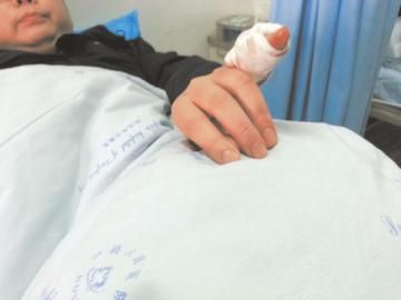 實習醫(yī)生陳洪左手的小拇指肌腱斷裂。