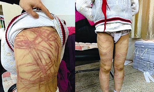 南京虐童案養(yǎng)母致歉:將用加倍關(guān)愛彌補(bǔ)過失 南京虐童案養(yǎng)母致歉:將用加倍關(guān)愛彌補(bǔ)過失