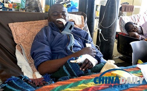 雖然已經(jīng)在醫(yī)院接受了近一個月的恢復(fù)治療，卡托卡的身體仍然非常虛弱。