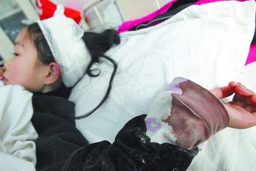 老師用教鞭敲打?qū)W生致頭破血流 老師用教鞭敲打?qū)W生致頭破血流