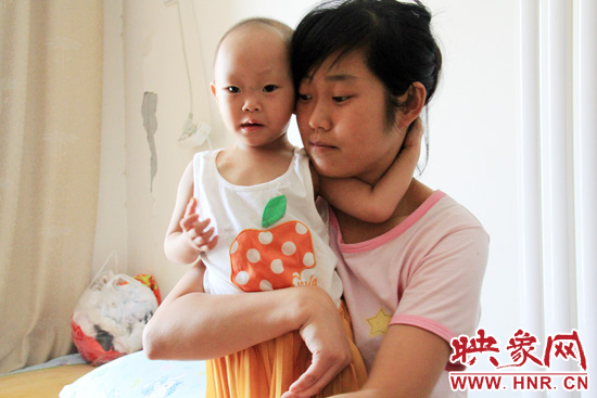 孩子和媽媽在一起，她的右眼已經(jīng)失明。