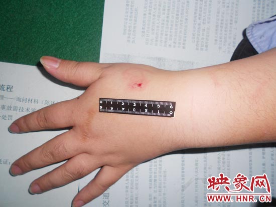 為幫助無證駕駛的朋友逃避處罰，新鄉(xiāng)的王某竟對執(zhí)勤民警大打出手，還將一名民警的手臂咬傷