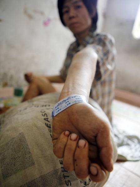 真實(shí)記錄一個吸毒者生命最后19天