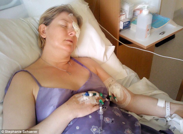 恐怖慎入！隱形眼鏡致英女子摘除眼球