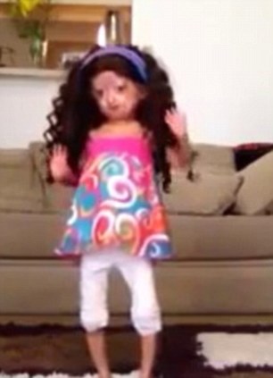 女童患罕見早衰癥 女童患罕見早衰癥