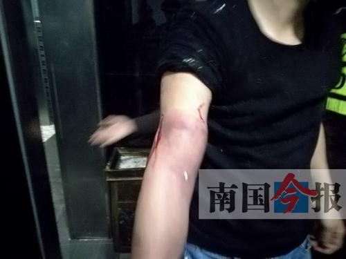 覃先生手臂被卡的部位受傷流血，所幸傷勢無大礙。 通訊員 王建民 攝