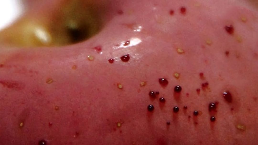 嚇懵！女子用熱水泡蘋果結(jié)果冒出血珠 咋回事？