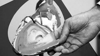 威廉斯領(lǐng)導(dǎo)的研究團(tuán)隊已經(jīng)利用人體脂肪干細(xì)胞，成功3D打印出心臟血管和心臟瓣膜，待一顆心臟的所有部件打