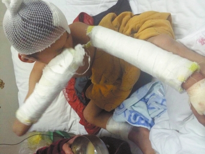 受傷的陳勝達 受傷的陳勝達