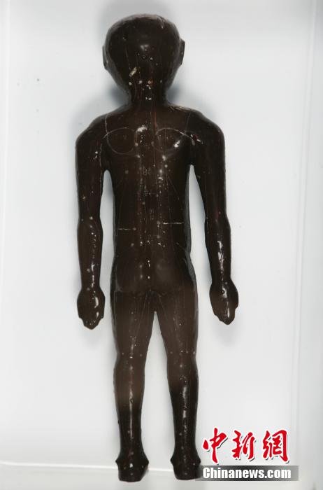 圖為出土的人體經(jīng)穴漆俑。