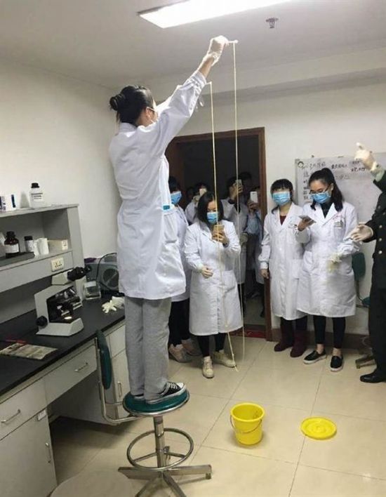 愛吃生肉惹的禍！男子體內取出5米長寄生蟲(圖)