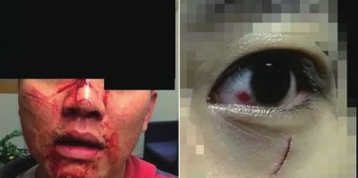 中國(guó)留學(xué)生新西蘭頻遭襲擊 警方被斥不作為