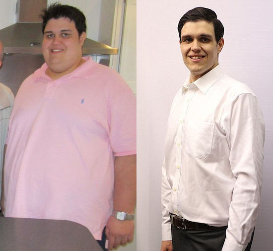 英體重418斤男子穿銅質鞋墊減肥 18個月減254斤 英體重418斤男子穿銅質鞋墊減肥 18個月減254斤