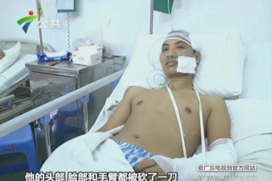 另一名傷者頭部、臉部和手臂都被砍了一刀。(視頻截圖)