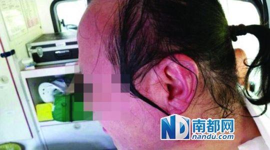 涉事教師遭熱水潑臉后的照片。