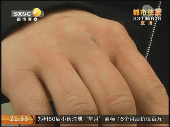 說(shuō)到這足療拔罐，估計(jì)大伙都不陌生，但是想起4號(hào)晚上的拔罐的經(jīng)歷，呂先生現(xiàn)在想起來(lái)，還心有余悸。