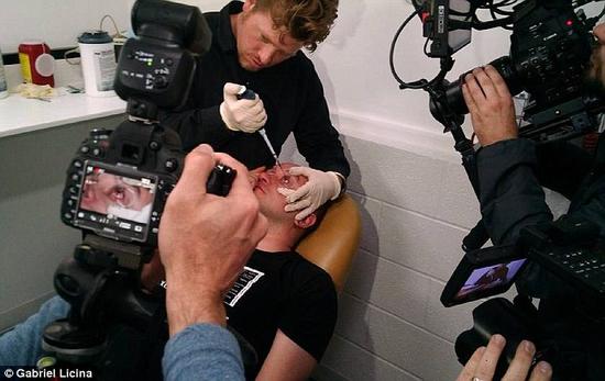 該實(shí)驗(yàn)是由加州一支名為“生物駭客”的實(shí)驗(yàn)團(tuán)隊(duì)開(kāi)展的。他們使用了一種名為二氫卟吩e6（Ce6）的物質(zhì)的溶液。Ce6常見(jiàn)于深海魚(yú)體內(nèi)，有光敏特性，通常用于癌癥治療研究中。研究團(tuán)隊(duì)將Ce6與胰島素和鹽水混合起來(lái)，得到一種溶液，可以在低光照條件下提高人類(lèi)的視力。