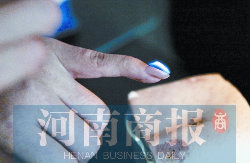 將指甲油涂在指甲上，靠近火焰時被引燃了