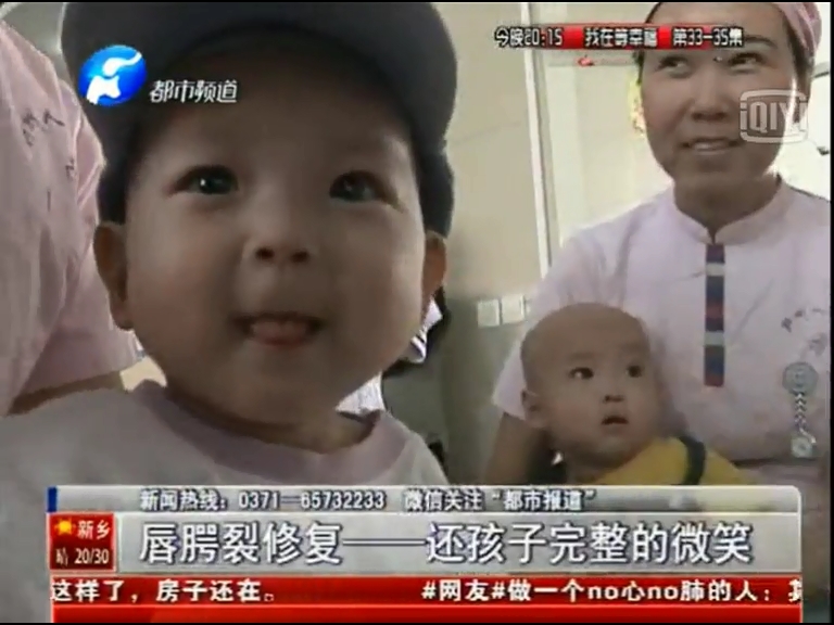鄭州人民醫(yī)院免費唇腭裂手術(shù)