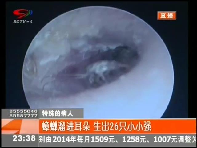 小強(qiáng)溜進(jìn)耳朵？生26只小小強(qiáng)